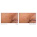 Retinol Correxion&reg; Line Smoothing Siero Viso Notte in Capsule RoC&reg; 30 Capsule