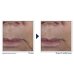 Multi Correxion&reg; Firm + Lift Crema Viso RoC&reg; 50ml