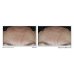 Multi Correxion&reg; Hydrate + Plump Idratante Viso SPF 30&nbsp;RoC&reg; 50ml