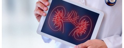 Come si formano i calcoli renali: cause e rimedi
