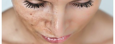 Quali sono i migliori sieri per eliminare le macchie dal viso?