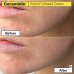 Ceramidin&trade; Ectoin&reg;-Infused Cream Dr. Jart+ 50ml
