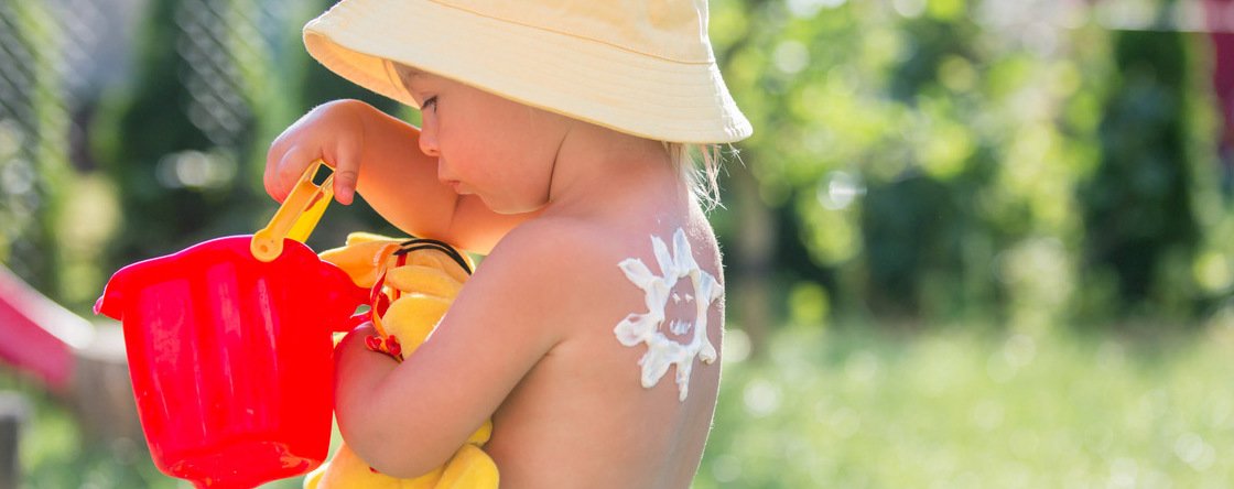 Come curare l'eritema solare nei bambini?
