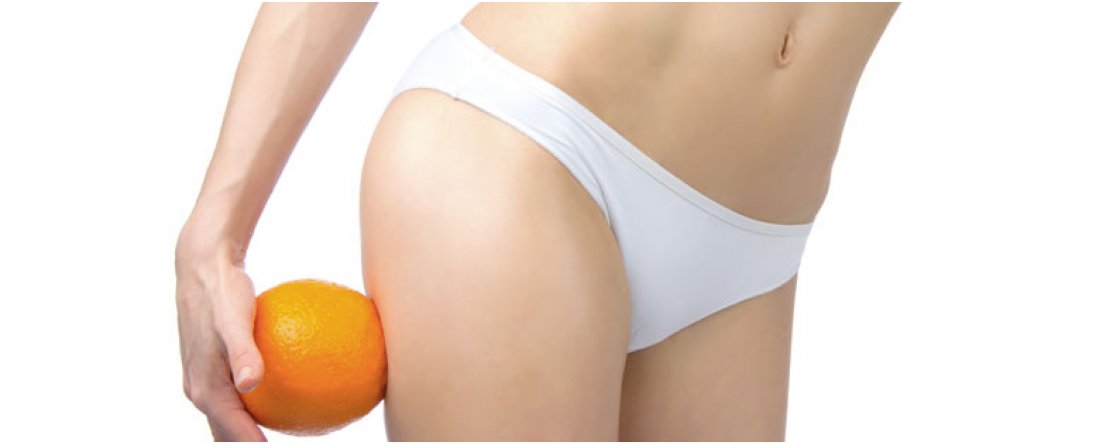 Qual è la differenza tra ritenzione idrica e cellulite?