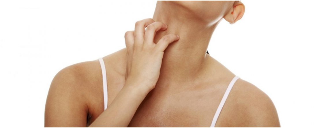 La Dermatite Polimorfa Solare: l’allergia al sole più diffusa