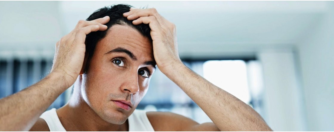 Come Prevenire la Caduta dei Capelli
