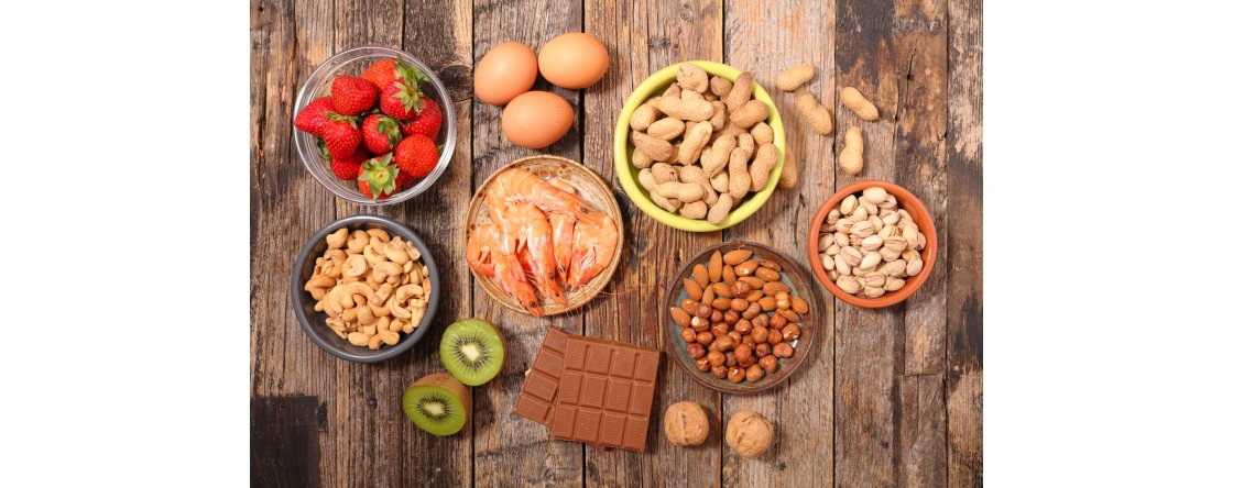 Allergie alimentari, cosa sono e quali sono i sintomi