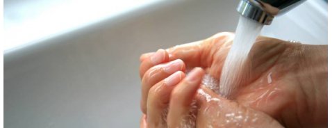 Tutto ciò che devi sapere sulle ustioni di primo grado Tutto ciò che devi sapere sulle ustioni di primo grado