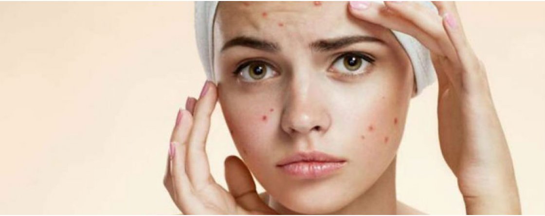 Routine di bellezza per pelli grasse