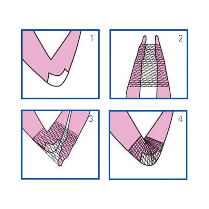 RETE TUBOLARE ELASTICA CALIB 3