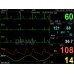 P16 MONITOR MULTIPARAM PC3000